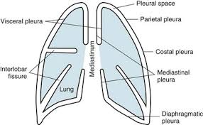 Pleural Disease Thoracic Key
