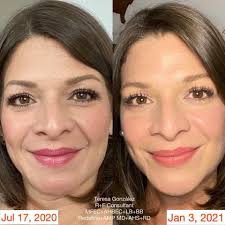 Brittany Burris- Rodan+Fields Independent Consultant