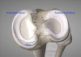 Maybe you would like to learn more about one of these? Meniskus Kleben In Koln Orthopadie Rheinauhafen