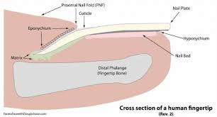 Image result for paronychium