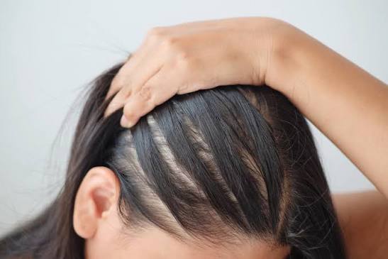 O que é bom para queda de cabelo? 5 dicas que vão te ajudar!
