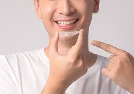 Invisalign Brookswood - Langley BC - Invisible Teeth Aligners