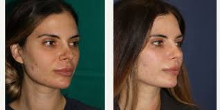 Alfredo Fernandez Blanco, MD, Plastic Surgeon