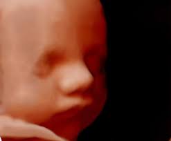 The Detty Sisters added a new photo.