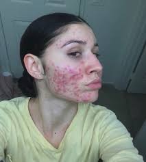 Renee Bayless (@BaylessRenee)