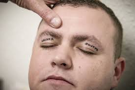 Northern Ireland man has 'whata boutye' eyelid tatoo removed year