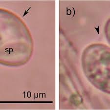 Image result for Balantoides Coli