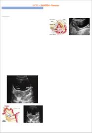 Grátis: Resumo Imagem - UC 11 saúde da mulher - Material Claro e Objetivo  em PDF para Estudo Rápido