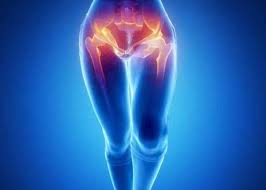 Image result for Snapping Hip