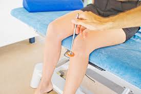 Image result for Reflex Exam