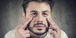 Maybe you would like to learn more about one of these? Cara Memutihkan Mata Kuning Agar Kembali Putih