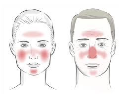 Image result for red rash face