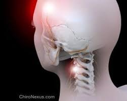 Can a chiropractor help a pinched nerve in neck. Pin On Chiropractor