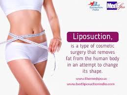 Best Liposuction India Vaser Liposuction An Overview Liposuctionindelhi Liposuctioncostindelhi Lip Liposuction Tumescent Liposuction Cosmetic Surgeon