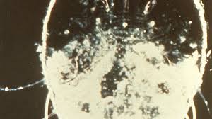 See the video about how to do this on this page. Ivermectin Als Tablette Zugelassen Apotheke Adhoc