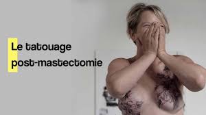 A new strategy for prophylactic surgery in brca women: Cancer Du Sein Quand Le Tatouage Aide A Se Reconstruire Youtube