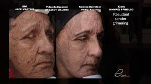 Dr Riekie Smit bespreek Annetjie se prosedures op Dr. Nou!