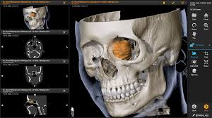 Maybe you would like to learn more about one of these? Elements Dicom Viewer Web Based Brainlab