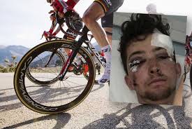 Brit pro cyclist recovering after horror smash with van in Spain « Euro  Weekly News
