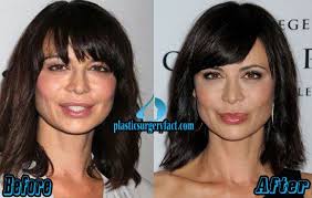 Catherine Bell Plastic Surgery Before And After Photos Catherine Bell Plastic Surgery Celebrity Plastic Surgery