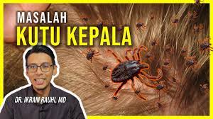 Sebenarnya penularan kutu rambut bukan karena si kutu jago melompat atau memiliki sayap untuk terbang. Kutu Rambut Kepala 2 Tips Cara Mengatasi Masalah Kutu Kepala Ubat Kutu Kepala Youtube