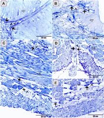 Choose a vocabulary word and type it into the middle box. Morphological And Immunohistochemical Phenotype Of Tcs In The Intestinal Bulb Of Grass Carp And Their Potential Role In Intestinal Immunity Scientific Reports