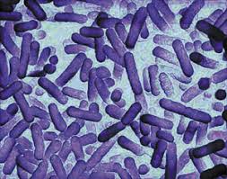 Legionellosis is a respiratory disease caused by legionella.: Ikz Haustechnik