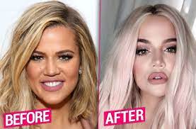 Khloe Kardashian Is Definitely Keeping Up With Plastic Sisters Kim And Kylie Jenner Khloe Kardashian Plastic Surgery Kardashian Plastic Surgery Plastic Surgery