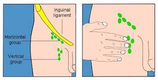 Maybe you would like to learn more about one of these? British Association Of Dermatologists Patient Information Leaflets Pils