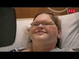 1000-lb Sisters' Star Tammy Slaton Reveals Jaw-Dropping Results of Her Skin  Removal Surgery