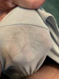 Maybe you would like to learn more about one of these? Tmi Mucus Plug Starting To Dissolve Babycenter