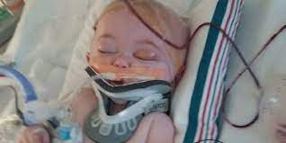 Check spelling or type a new query. Baby Left With Brain Damage After Fall From Queen Bed Sleeping In Adult Bed Leaves Baby At Risk