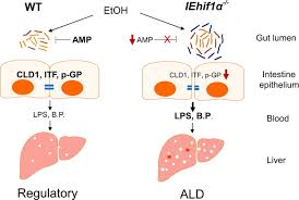 Gene expression heatmaps for mhc class i (a), class ii (b), and other antigen processing and presenting (c) genes. Intestinal Hif 1a Deletion Exacerbates Alcoholic Liver Disease By Inducing Intestinal Dysbiosis And Barrier Dysfunction Journal Of Hepatology