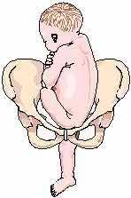 Image result for Compound Presentation