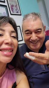 Relleno de labios con Ácido hialurónico #rellenos #rellenosfaciales  #rellenodelabios