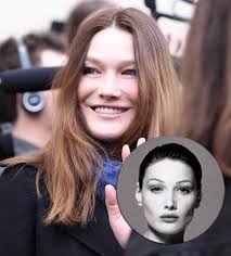 This biography of carla bruni provides detailed information about her childhood, life. Carla Bruni Sarkozys Erstarrtes Botox Gesicht Ok Magazin