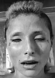 r/mildlyinteresting u/sLiimFit· 2h ·imgur• 6 1 S 3 4 Join My grandma's  titanium hip after the cremation. 6.9k 375 Share BEST COMMENTS + Award  Designer_Mongoose_90.1 •1h 5 Awards Make it it a