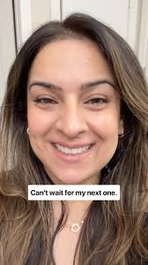 Check out my experience at @skin_medspa with my first @skinpen treatment!