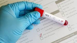 Gejala hepatitis a dan c adalah sama. Kenali Perbedaan Hepatitis A B Dan C Gejala Hingga Penyebabnya Tirto Id