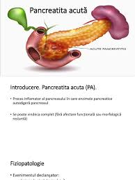 Examinarea fizică în caz de pancreatită acută. 19 Pancreatita Acuta Pdf