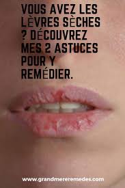 Nous aspirons tous à avoir de jolies lèvres pulpeuses et bien hydratées. Vous Avez Les Levres Seches Decouvrez Mes 2 Astuces Pour Y Remedier Wordpress