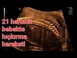 21 gebelik haftasi goruntuleri bebek yuzustu yatar pozisyonda hickiriyor anlatimli youtube