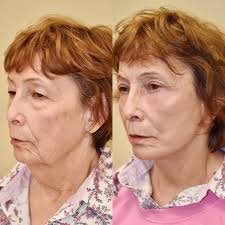 3.7 ⭐ Daniel Straka MD