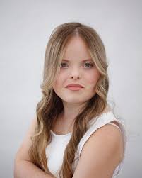 Modelo com Síndrome de Down é contratada por agência e quer chegar em  Hollywood - Revista Marie Claire | Notícias