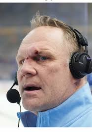 Rob Ray's Hilarious Reaction After Taking Puck to the Face