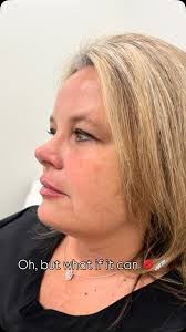 Always you, just enhanced 😘, Natural is always the goal here at Beverly  Aesthetics ✨💉💛, 👩🏼‍⚕️Ashlei Beverly APRN, FNP-C ,  (@injector.ashleibev), 👩🏻‍⚕️Hannah Gay LME ,  (@estihannah_beverlyaesthetics), ...