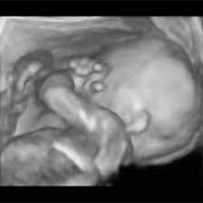 #1 xnmd1, aug 6, 2010. Week 20 Ultrasound What It Would Look Like Parents
