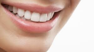 Veneer gigi snap on smile. Serba Serbi Tren Veneer Gigi Untuk Senyum Lebih Cantik Berseri Lifestyle Liputan6 Com