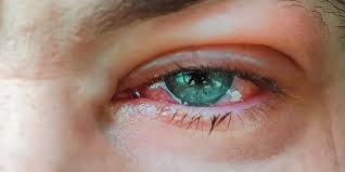 Image result for Blepharis transvaalensis