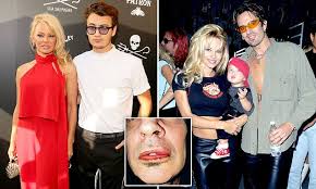 But much of the curiosity around pam & tommy is pointed at the central couple. Pamela Anderson Blasts Tommy Lee For Alcoholism Daily Mail Online